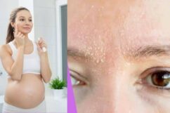 Peau très sèche visage grossesse : 5 conseils